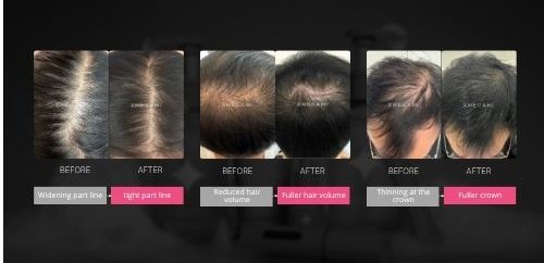 Hairdore hair care series for healthy scalp, stronger hair growth and fuller-looking hair